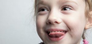 interdentale laterrale logopedia corsi ecm logosacademy